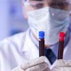 Realiza UACH en Facultad de Medicina el Diplomado en Hematología